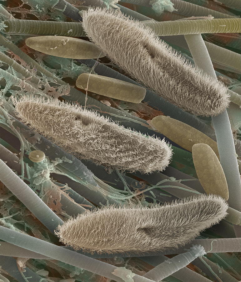 Wildlife Photograph - Paramecium Sp. Protozoa, Sem by Power And Syred