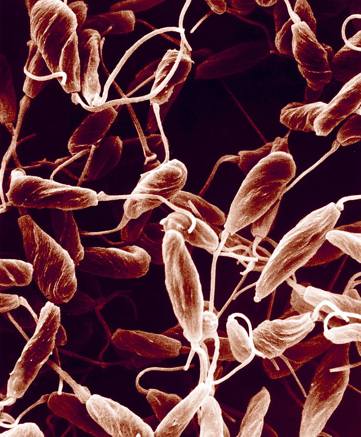 Protozoan Photograph - Parasitic Protozoa, Sem by Biomedical Imaging Unit, Southampton General Hospital