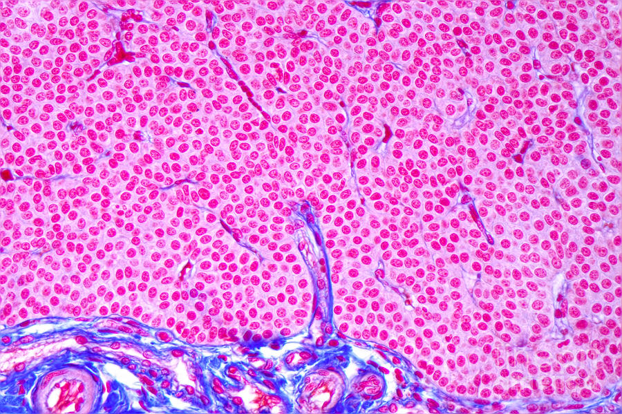 Light Micrograph Photograph - Parathyroid Gland Ts by M I Walker
