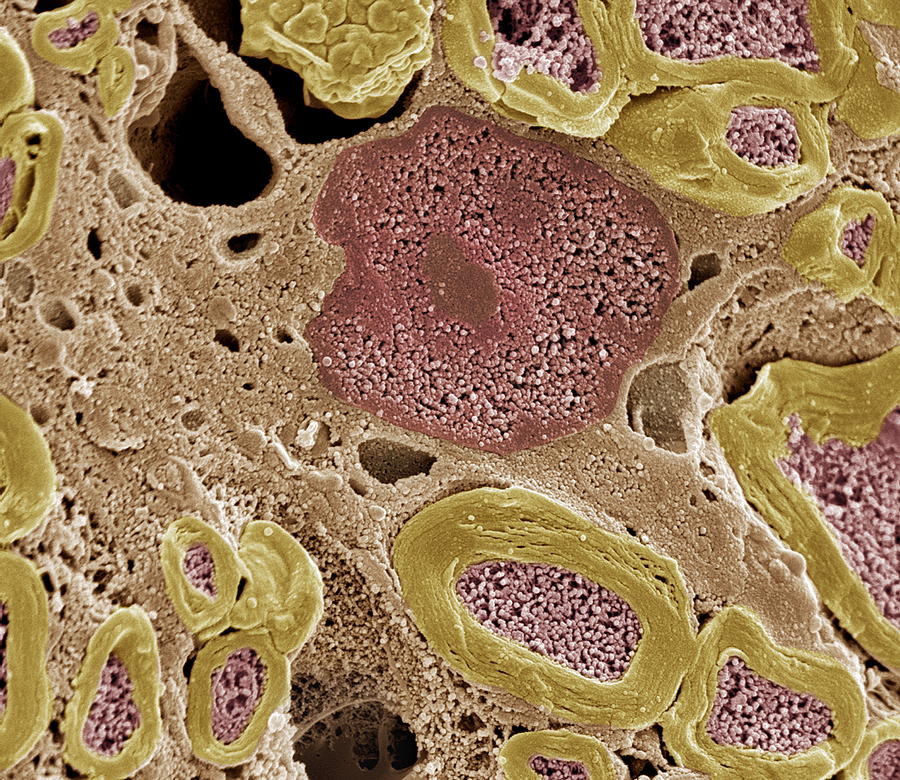 Peripheral Nerves, Sem by Steve Gschmeissner / Science Photo Library