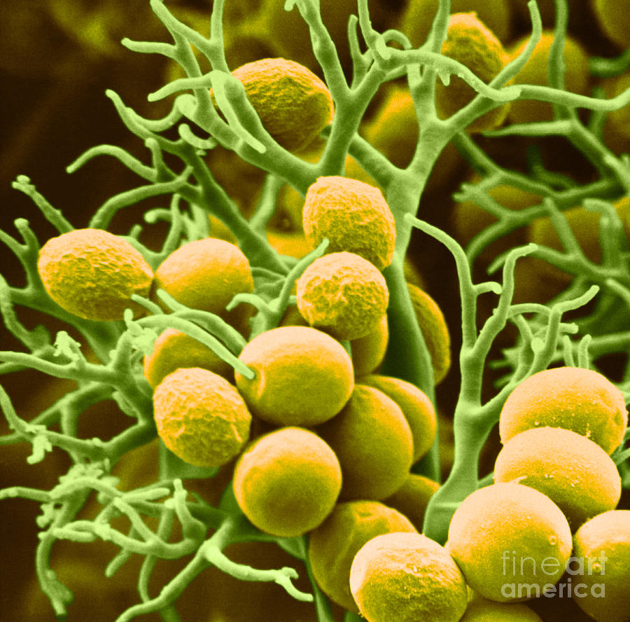 Peronospora Parasitica Photograph by Biophoto Associates and Photo ...