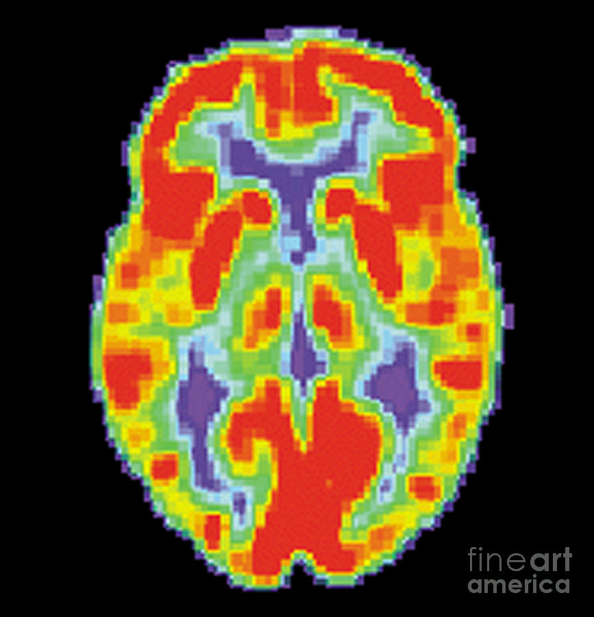 Pet Scan Of Normal Brain, 1 Of 2 Photograph by Science Source