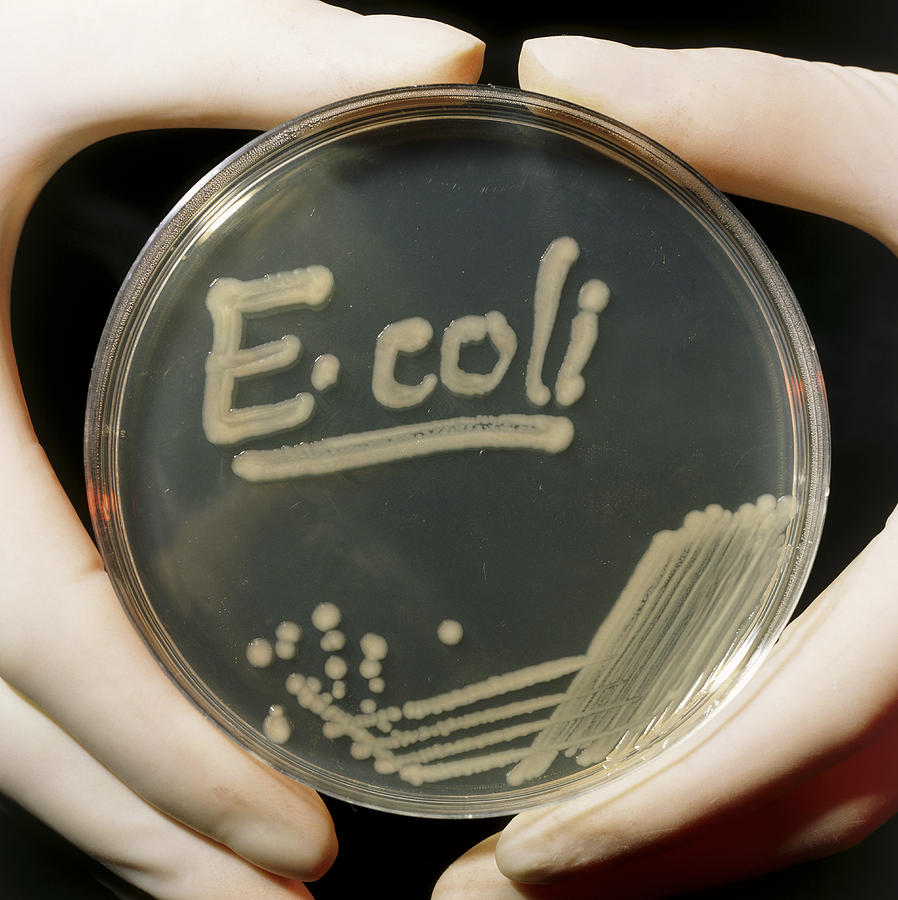 Gram Negative Bacteria Photograph - Petri Dish Culture Of E.coli Bacteria by Dr Jeremy Burgess