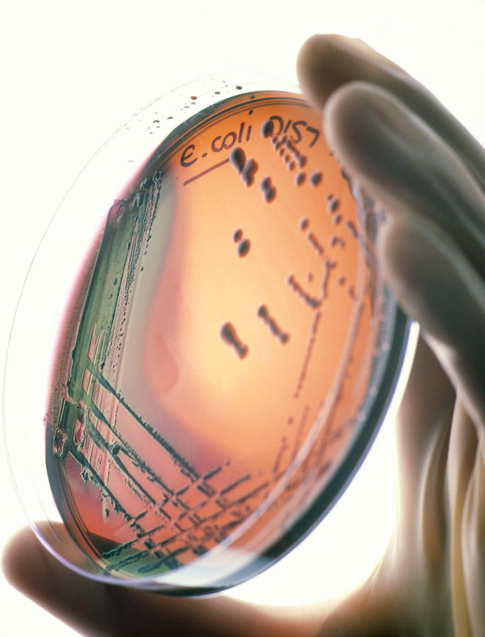 Petridish Culture Of Escherichia Coli 0157h7 Photograph by Tek Image