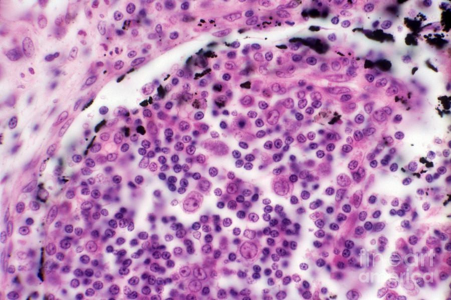 Phagocytosis Photograph - Phagocytosis by M. I. Walker