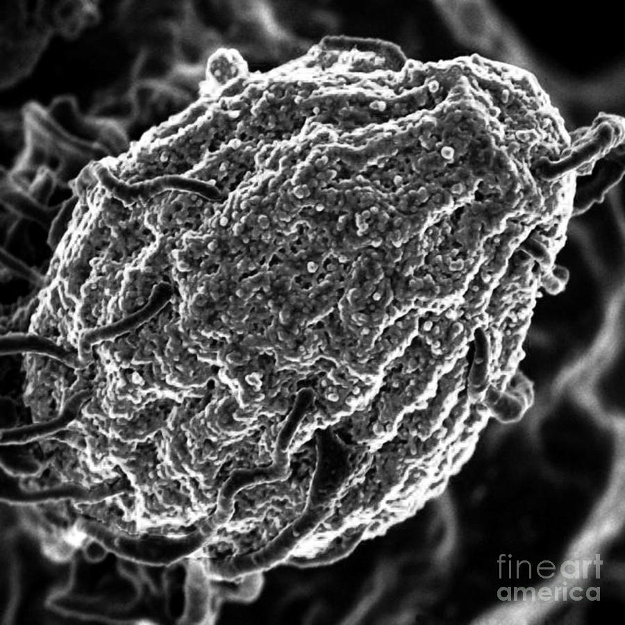 Phagocytosis Of Yeast Particle Photograph by Science Source