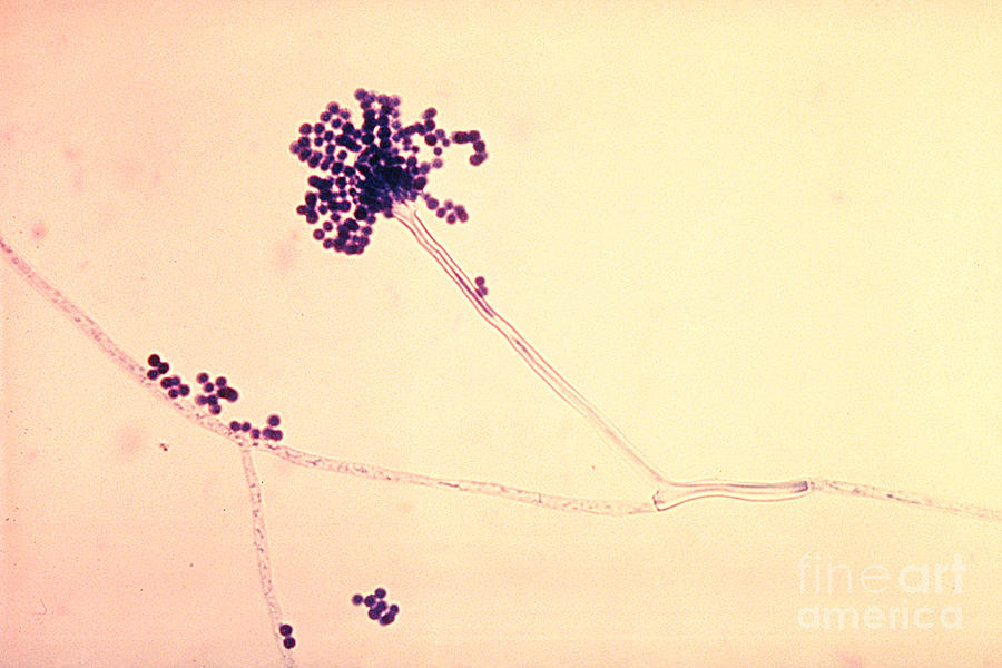 Fungi Photograph - Phialoconidia Of Aspergillus Fumigatus by Science Source