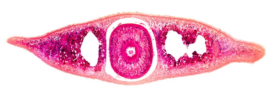 Planaria Flatworm Transverse Section Photograph By Dr Keith Wheeler 