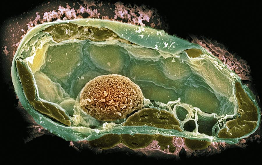 Nature Photograph - Plant Cell, Sem by Dr David Furness, Keele University