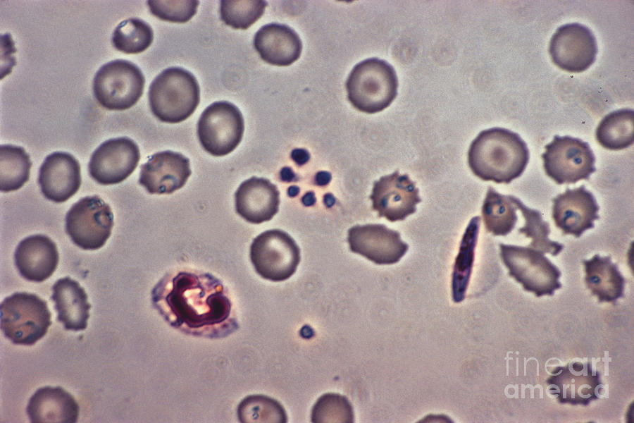 Plasmodium Falciparum Lm Photograph by Eric V. Grave