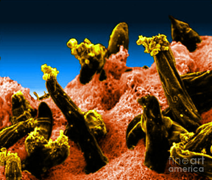 Microbiology Photograph - Plasmodium Gallinaceum, Sem by Science Source