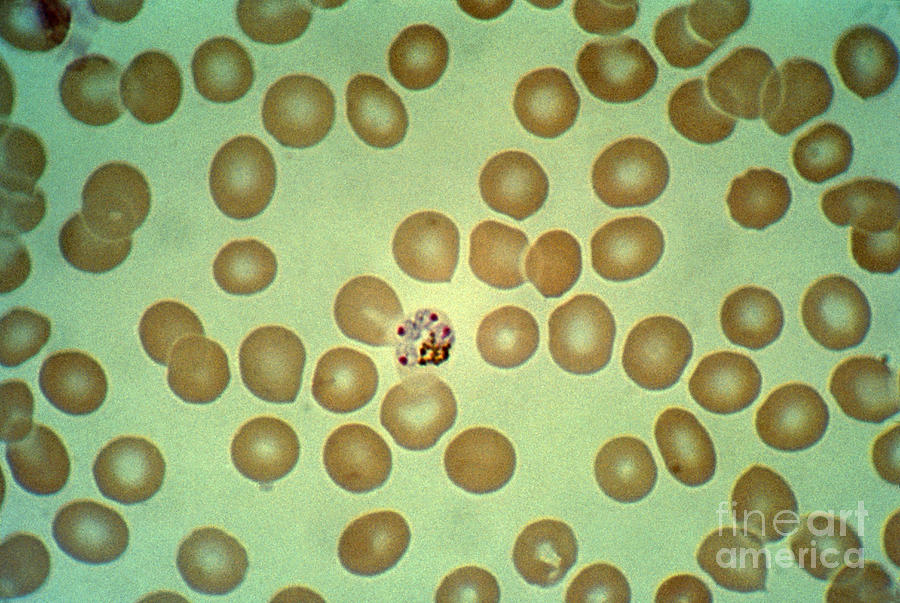 Plasmodium Malariae Lm Photograph by Science Source