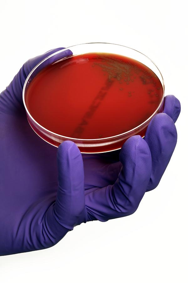Laboratory Technician Photograph - Pneumonia Bacteria In A Petri Dish by Doncaster And Bassetlaw Hospitals