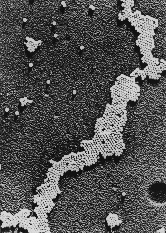 Polio Poliomyelitis Virus, The Cause Photograph by Everett