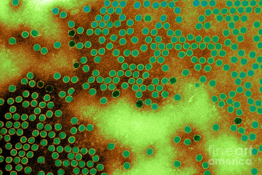 Poliovirus, Tem Photograph by Science Source