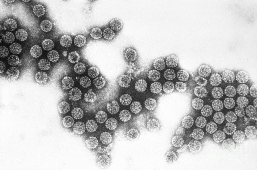 Polyoma Virus Sv40 Tem Photograph by Science Source