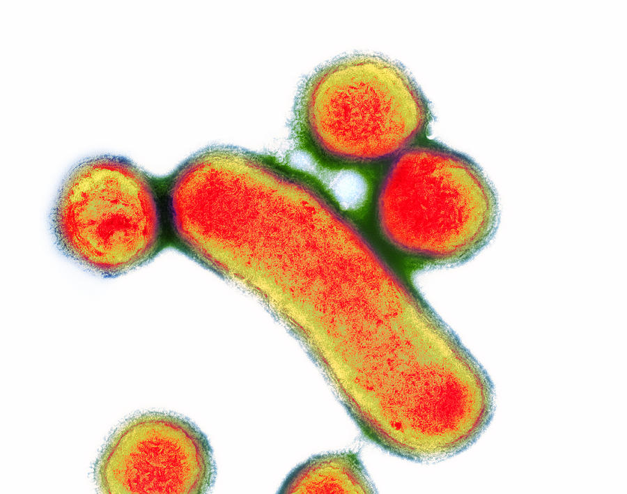 Porphyromonas Gingivalis Photograph - Porphyromonas Oral Bacteria, Tem by Hazel Appleton, Centre For Infectionshealth Protection Agency