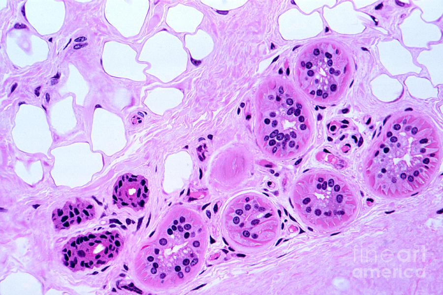Primate Sweat Gland Photograph by M. I. Walker