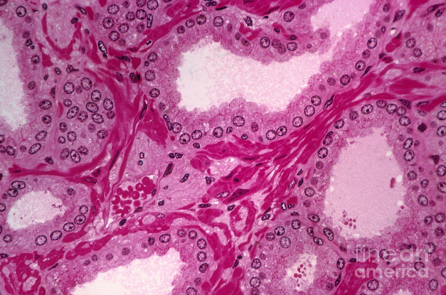 Prostate Gland Of A Monkey Lm Photograph by M. I. Walker