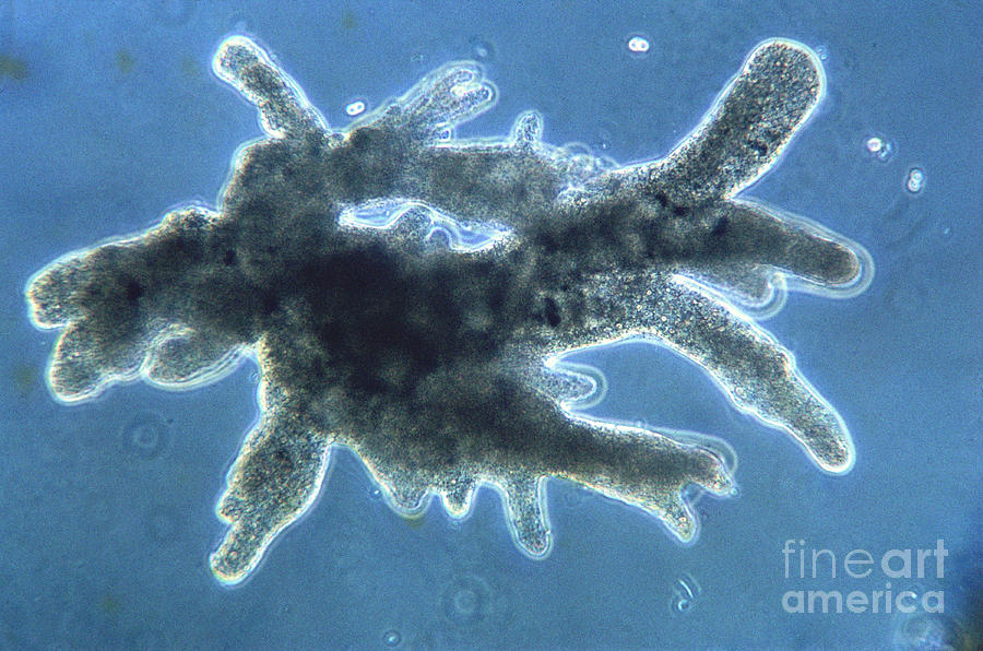 protozoa amoebe