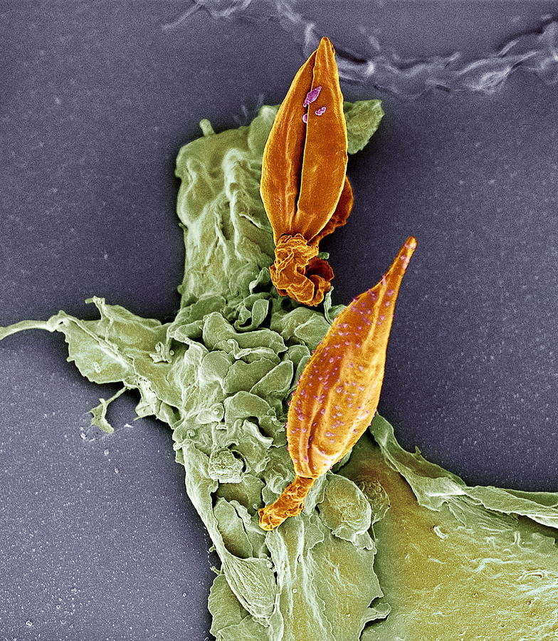 Wildlife Photograph - Protozoan Infecting Macrophage, Sem by 
