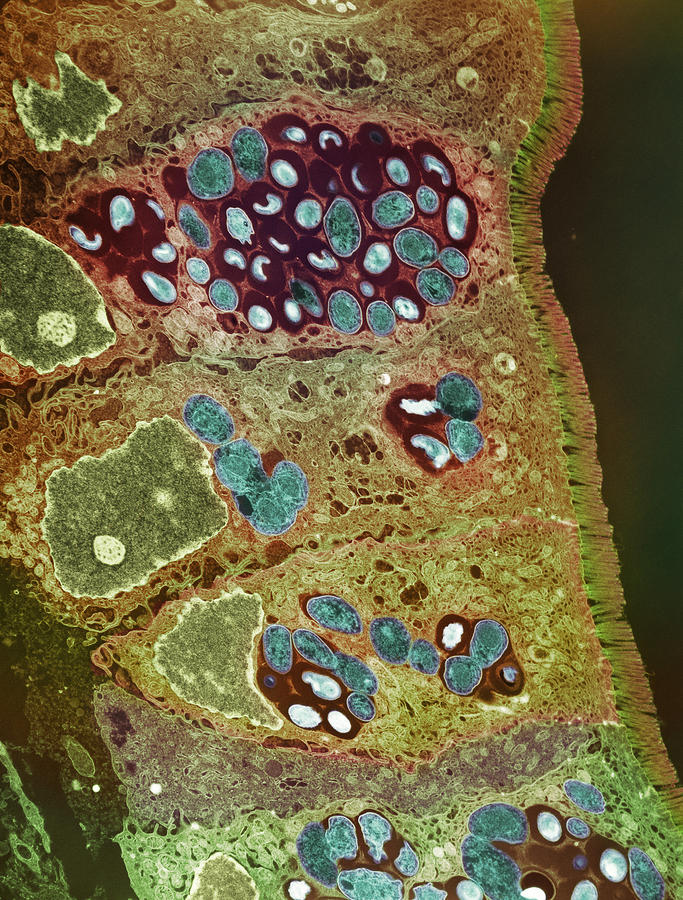 Protozoan Spore Formation, Tem Photograph by London School Of Hygiene ...