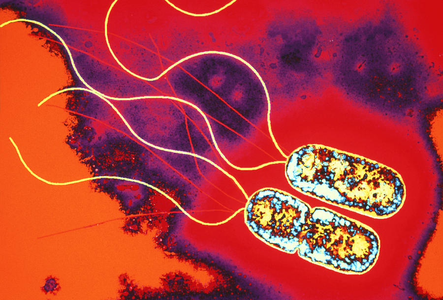 Bacteria Photograph - Pseudomonas Sp. Bacteria, Tem by Dr Linda Stannard, Uct