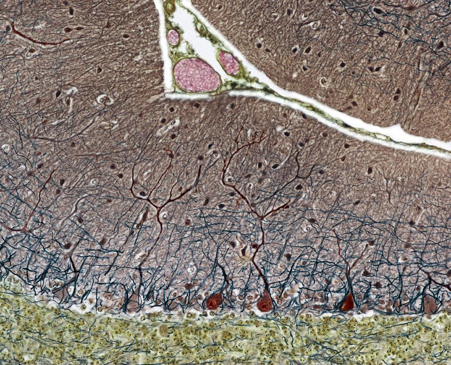 Anatomy Photograph - Purkinje Cells, Light Micrograph by Steve Gschmeissner