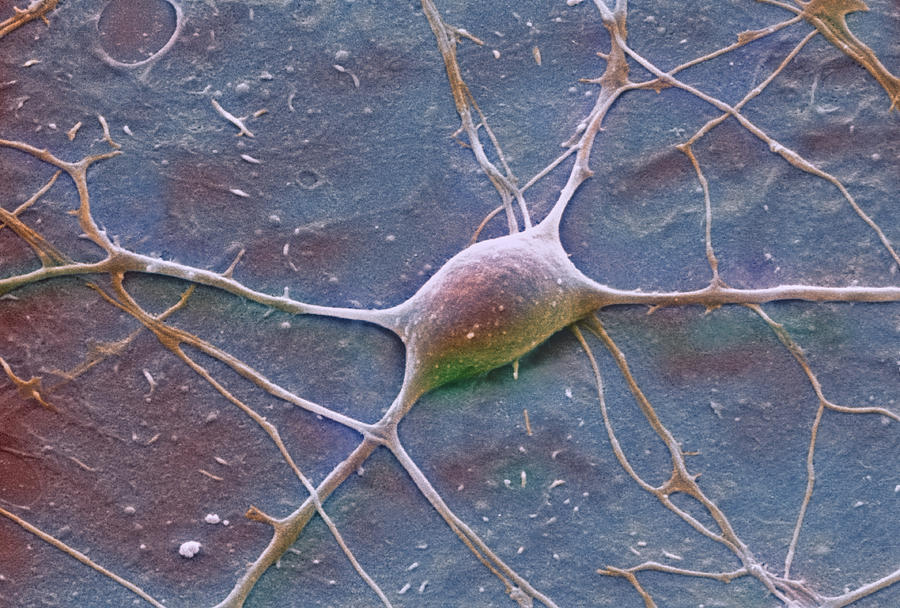 Histology Photograph - Purkinje Nerve Cell, Sem by David Mccarthy