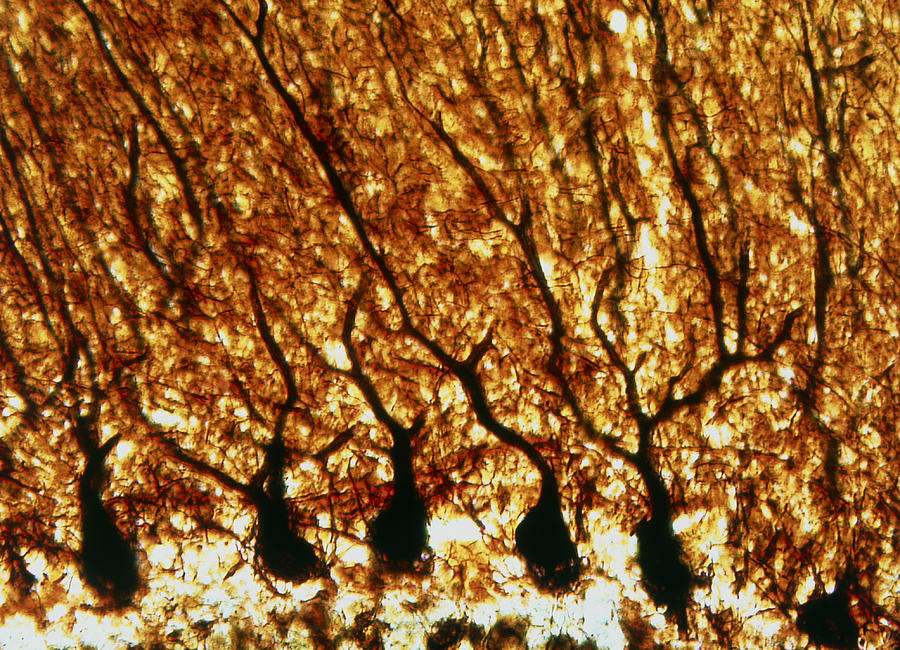 Purkinje Nerve Cells Photograph by Pasieka