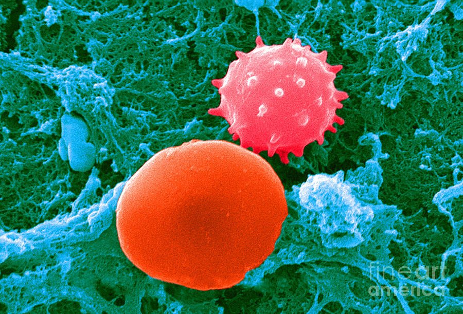 Red And White Blood Cells, Sem Photograph by Science Source