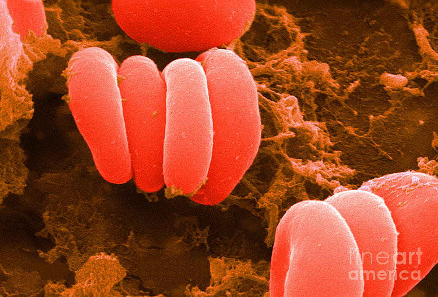 Red Blood Cells, Rouleaux Formation, Sem Photograph by Science Source