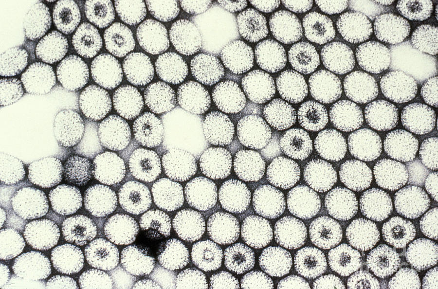 Reovirus Photograph by Science Source