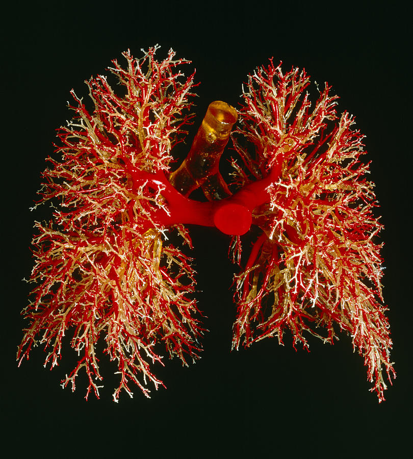 Resin Cast Of Pulmonary Arteries And Bronchi Photograph by Martin ...