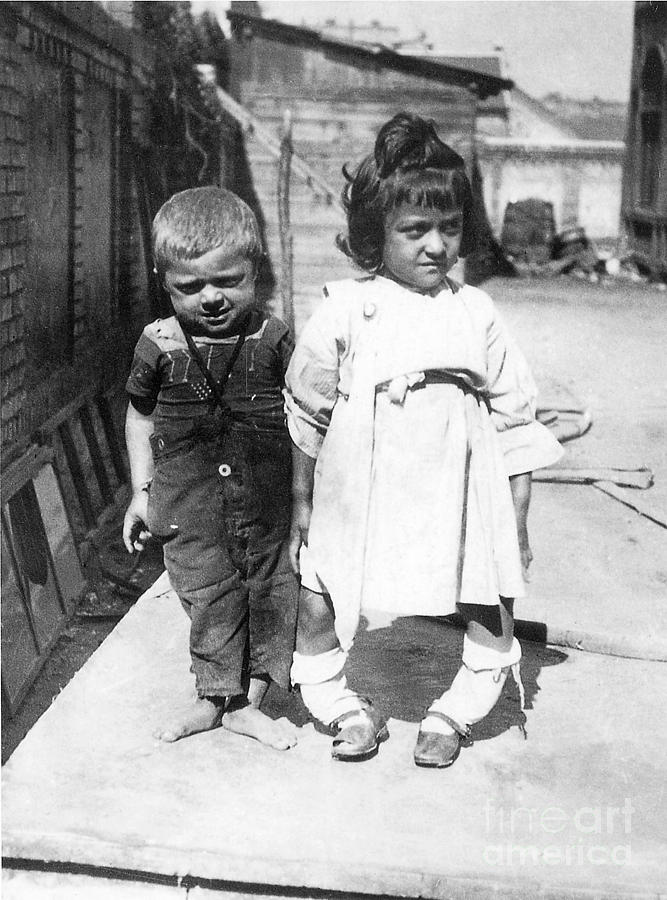 Rickets by Science Source