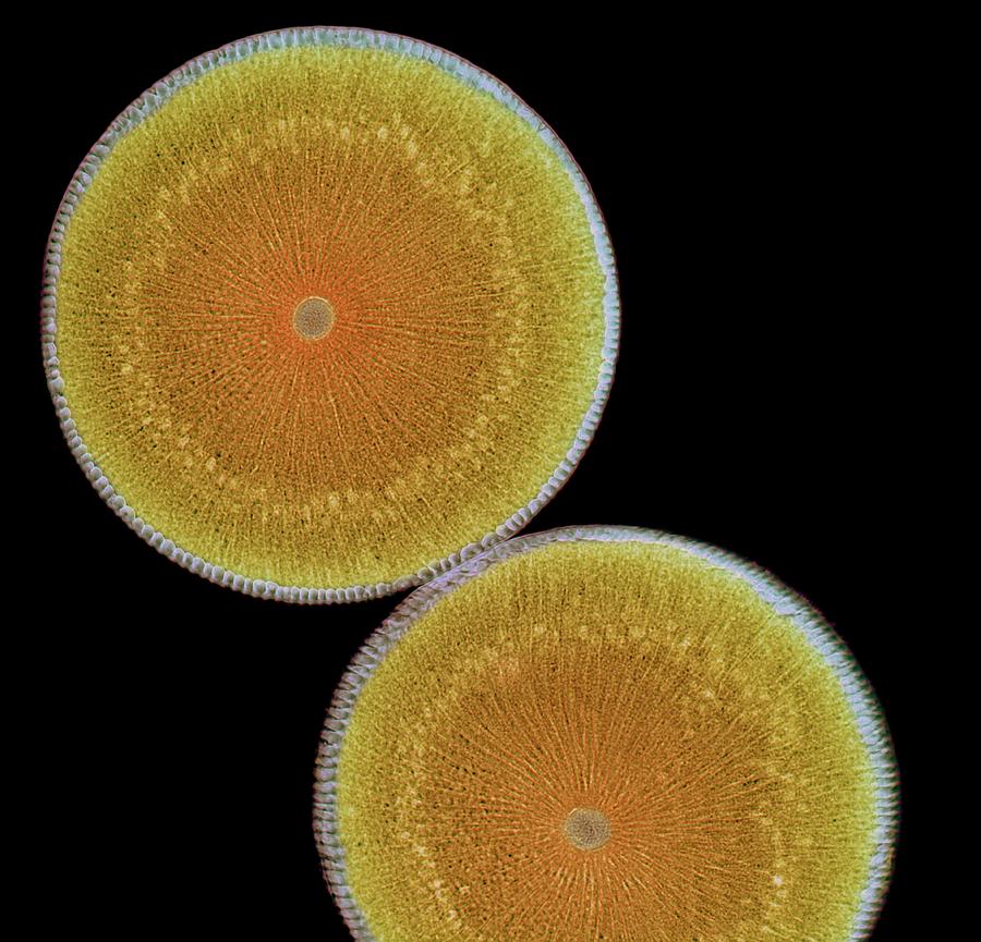 Roundworm Ovaries, Light Micrograph Digital Art by Steve Gschmeissner