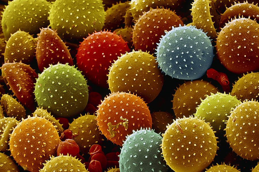 Ball Photograph - Rust Fungus Spores, Sem by Steve Gschmeissner
