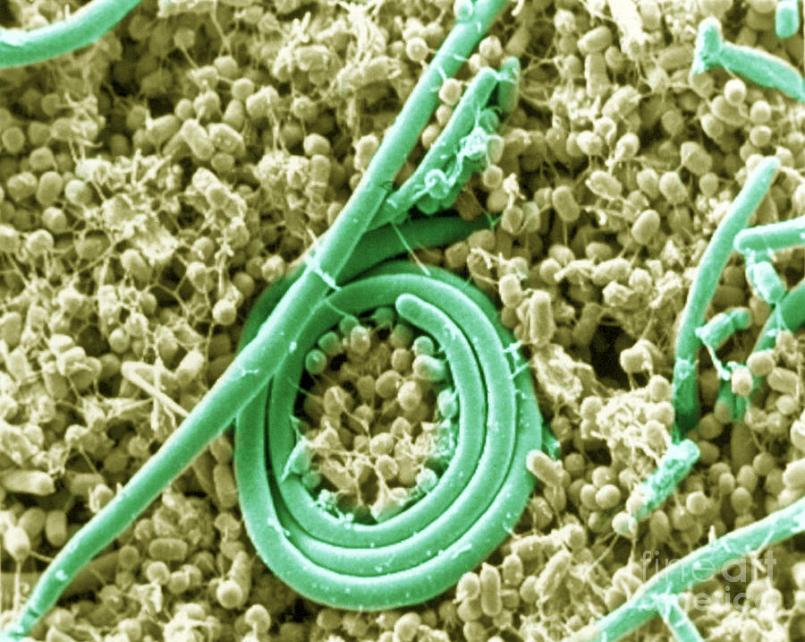 Salmonella Enteritidis Bacteria Photograph by Science Source