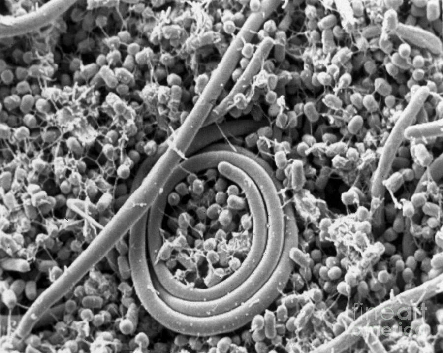 Salmonella Enteritidis Photograph by Science Source