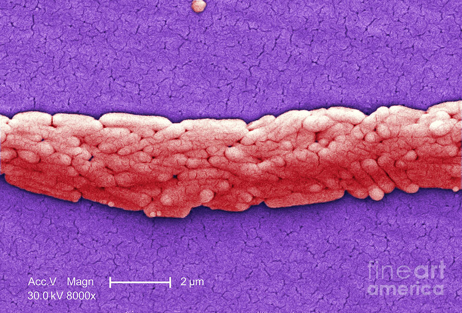 Salmonella, Sem Photograph by Science Source