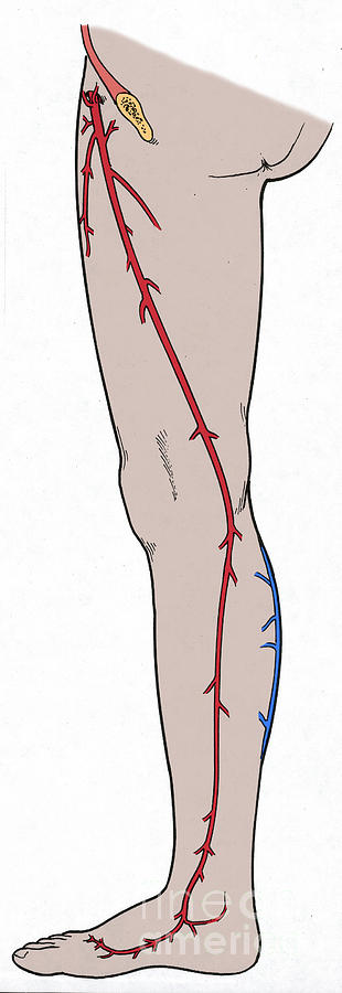 Saphenous Vein Photograph by Science Source