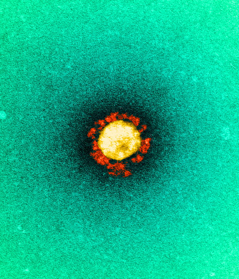 Sars Virus, Tem by Dr Klaus Boller