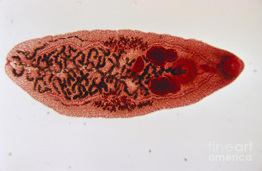 Schistosoma Japonicum, Lm Photograph by Eric V. Grave