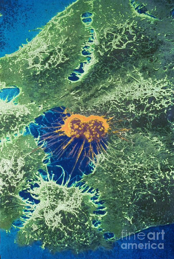Sem, Hela Cells With Adenovirus Photograph by Science Source