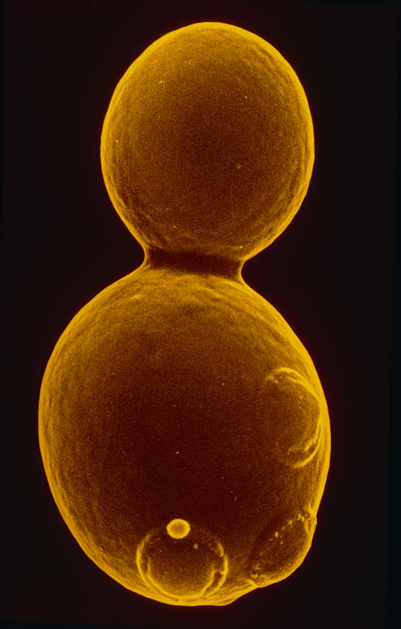 Sem Of Budding Yeast Photograph By J Forsdykegene Cox