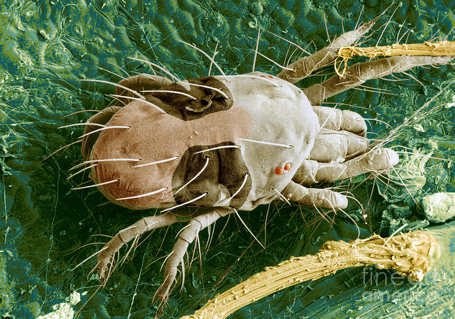 Sem Of Two-spotted Spider Mite Photograph by Science Source