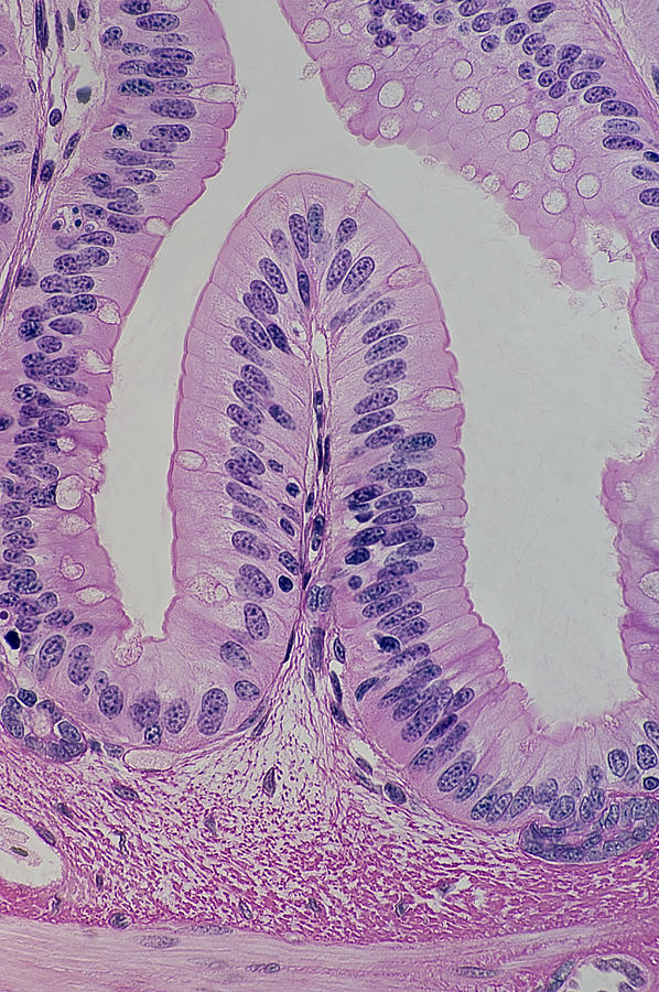 Simple Columnar Epithelium, Goblet Cells & Villus Photograph by Ed Reschke