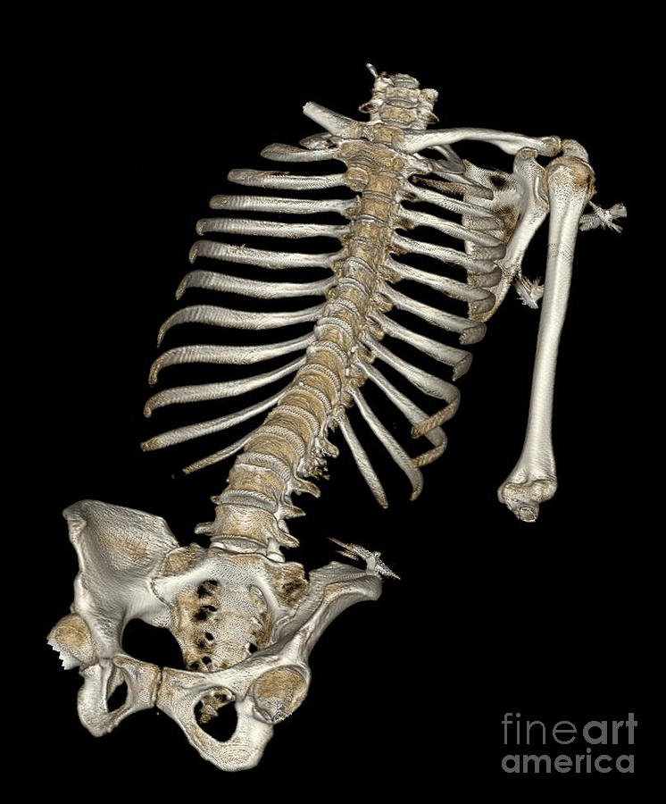 Skeleton Photograph - Skeletal Reconstruction by Science Source