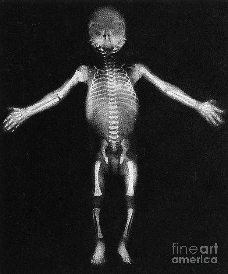 Skeleton Of A Baby Photograph by Photo Researchers