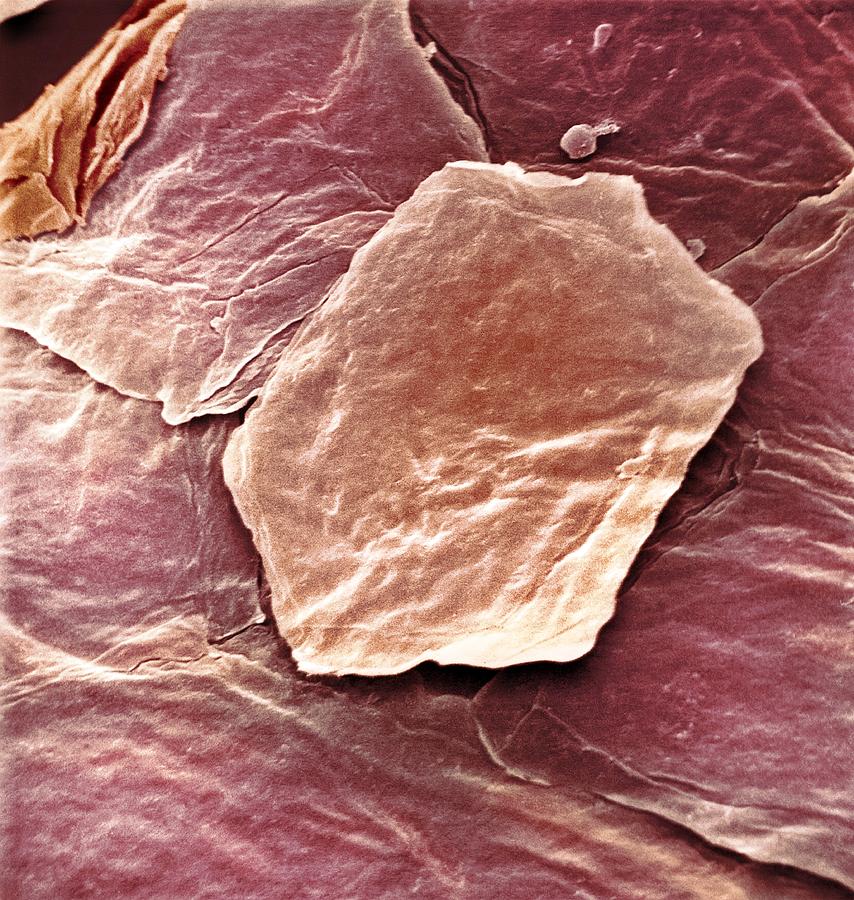 Skin Cell, Sem Photograph by